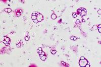 Salmonella typhi x320